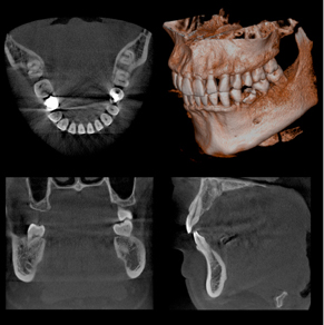 「歯科用3D・CT」を導入致しました
