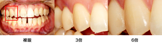 サージテル比較写真 サージテル比較写真